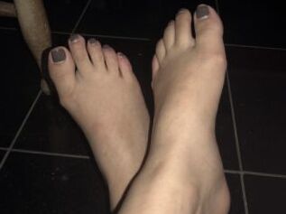 Tinytoes